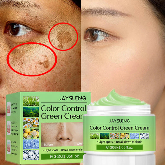 Whitening Freckles Cream Remove Melasma Dark Spot Lightening Melanin Brightening Melasma Remover Moisturize Anti-aging Face Care